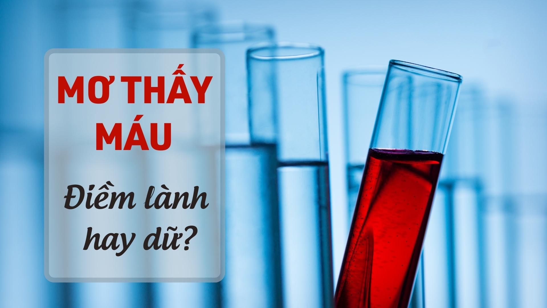 Mơ thấy máu là điềm gì? Phải làm gì?