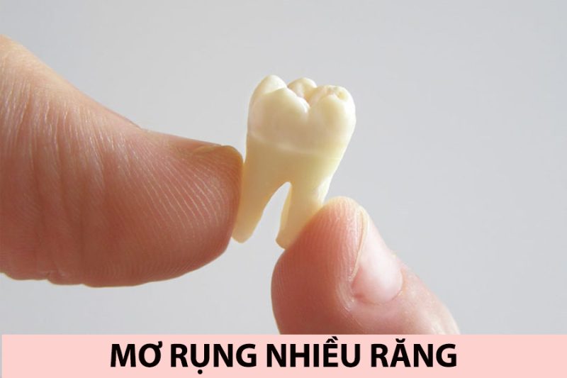 Đánh đề số mấy khi mơ thấy rụng răng?