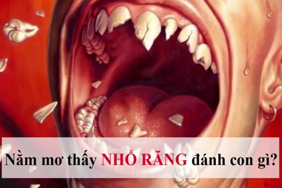 Mơ Thấy Nhổ Răng – FC88 Giải Mã Và Gợi Ý Con Số Đổi Đời